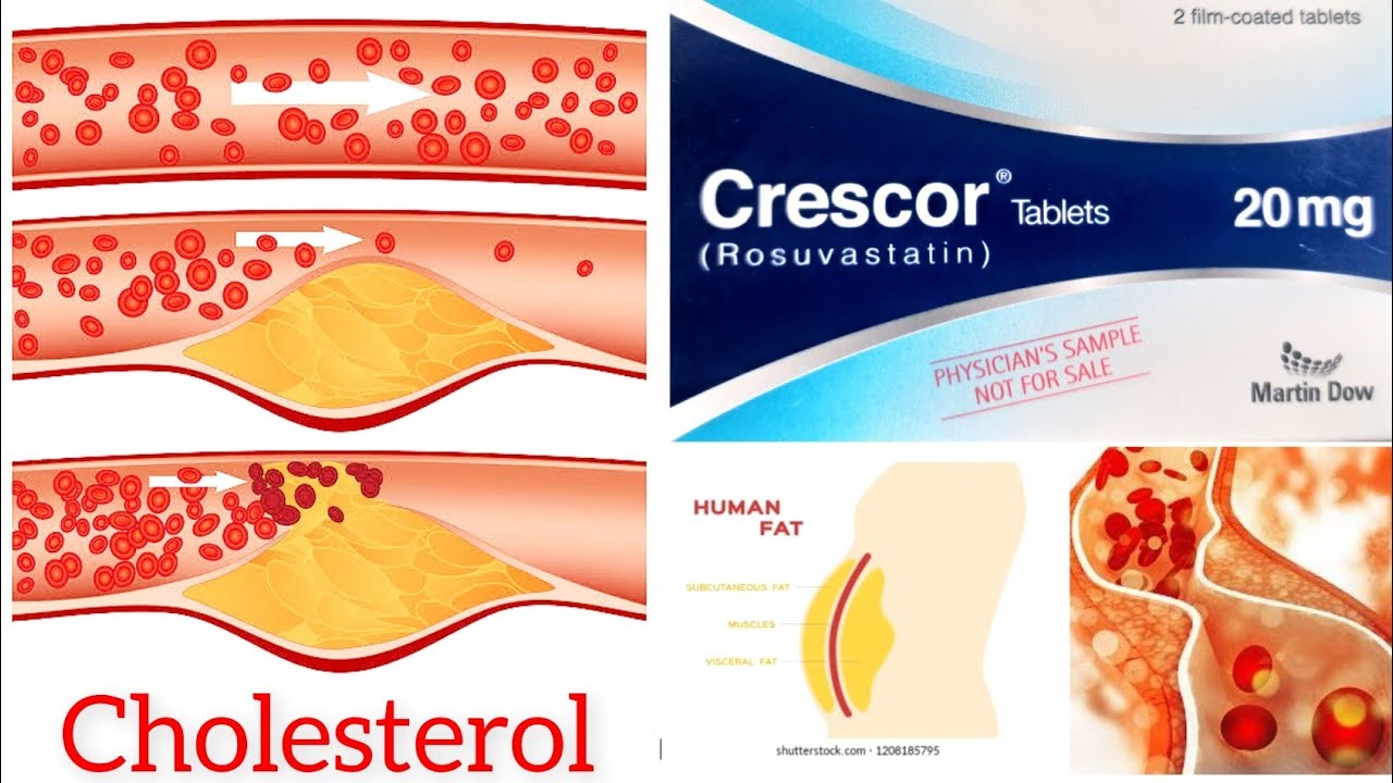 Crescor Tab 20mg 1x10's