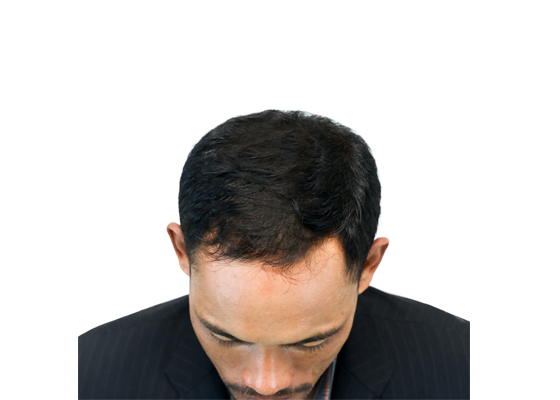 Foleca Shampoo 100ml — image 2 of 2